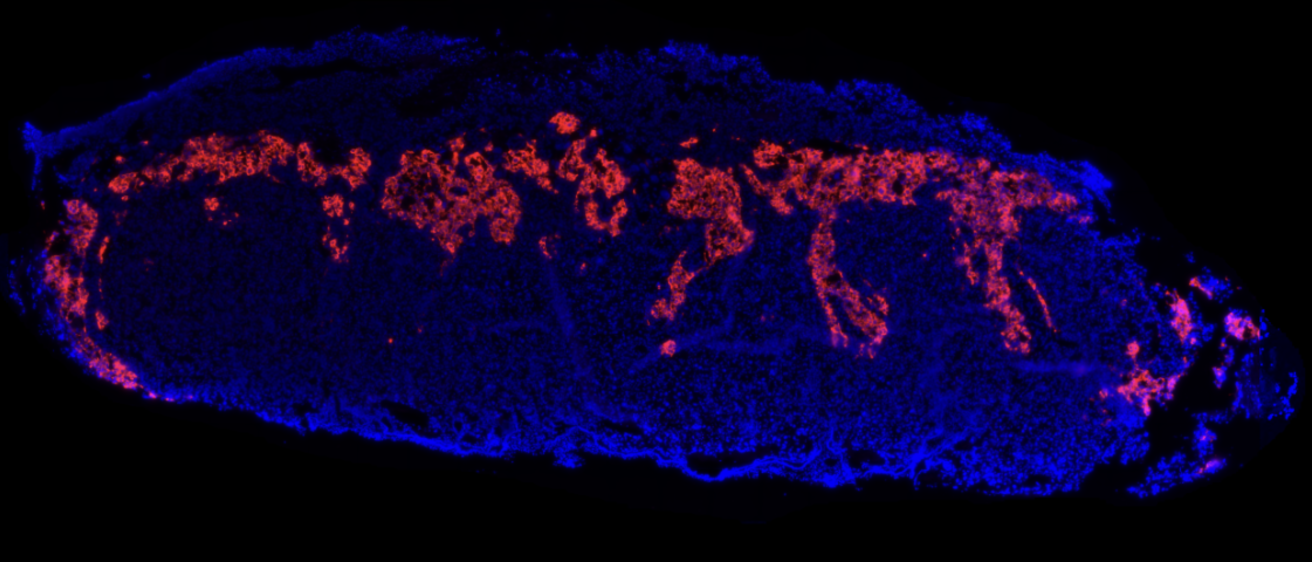 placenta immuno